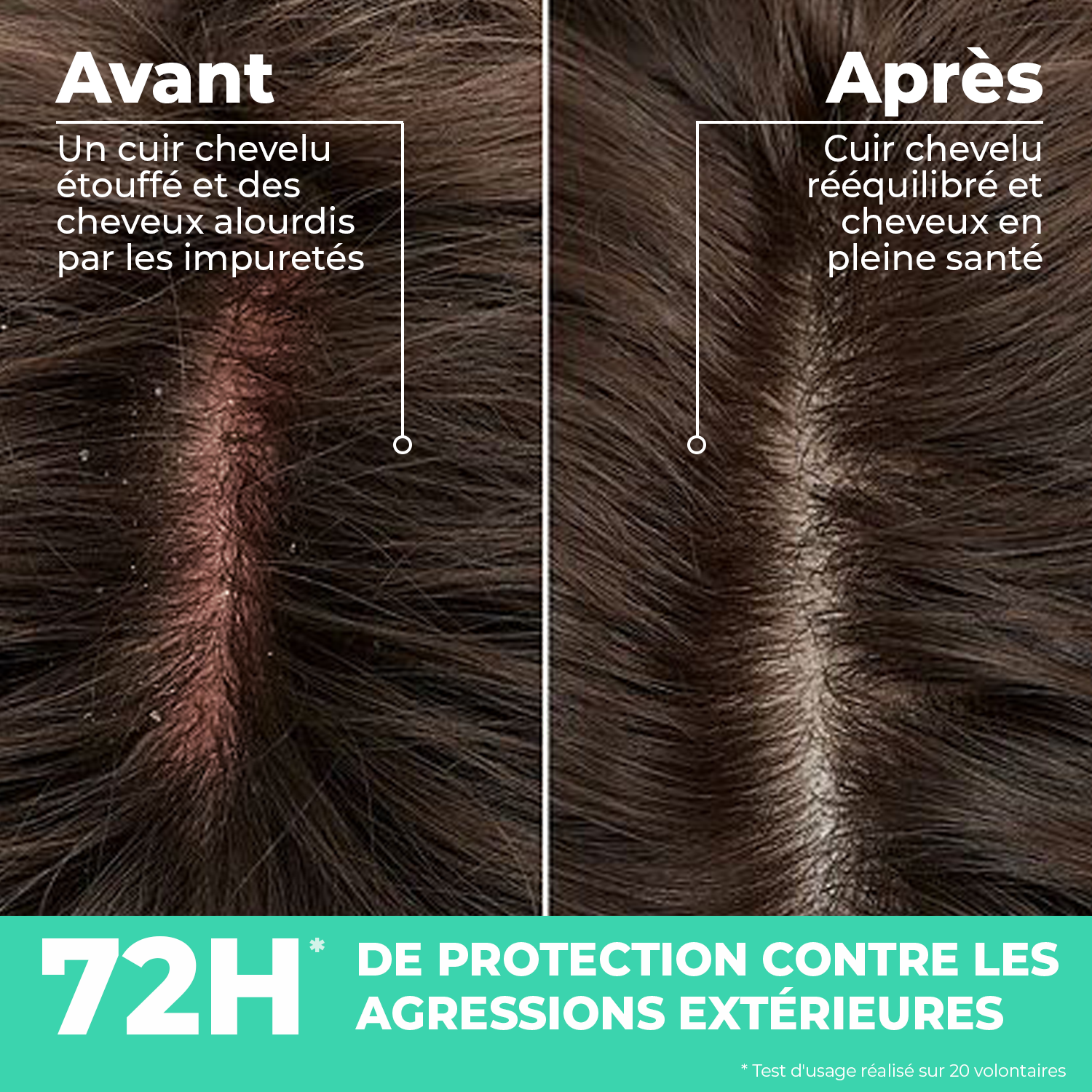 avant après du Sérum cuir chevelu hydra équilibrant centella asiatica et aloe vera 