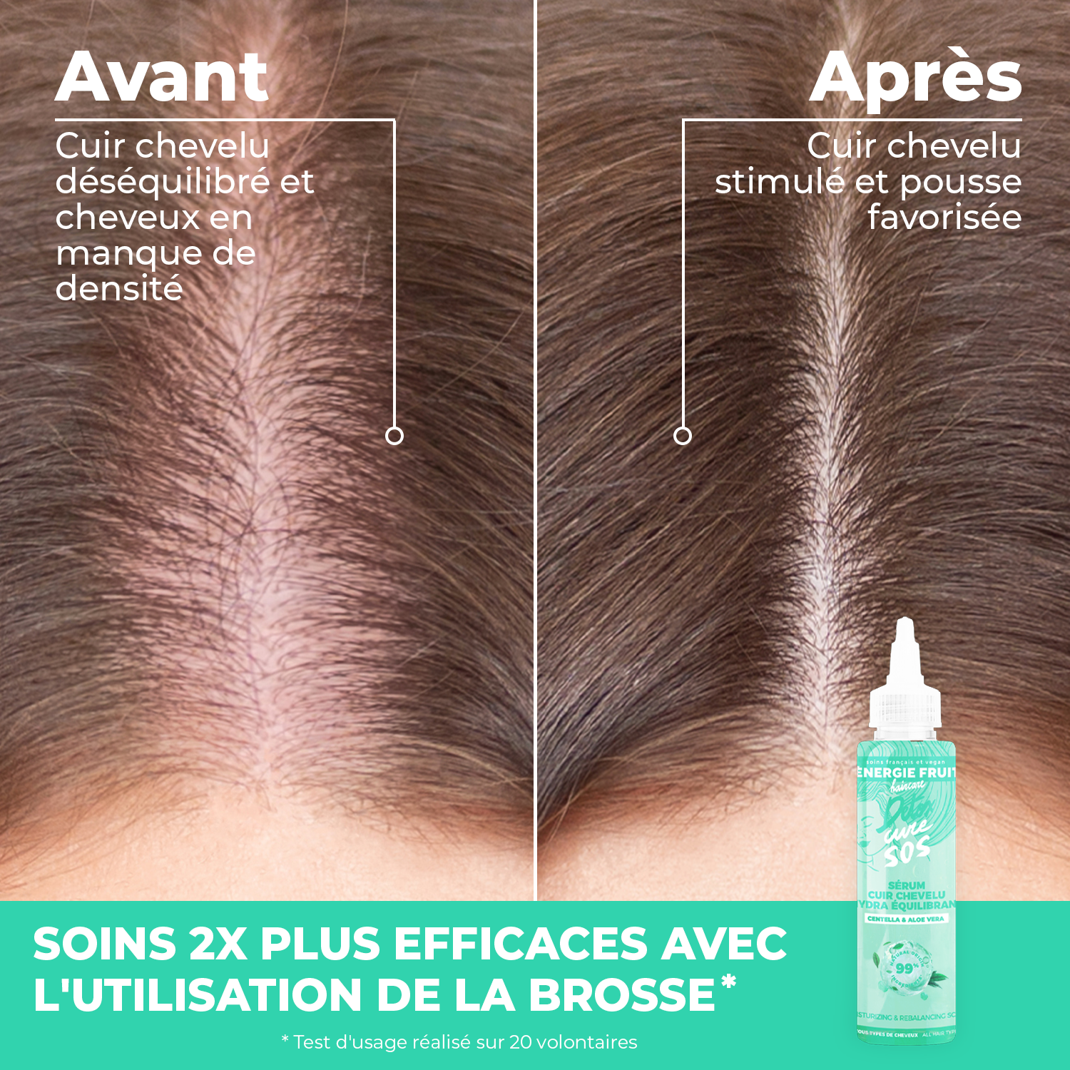 avant après utilisation du sérum detox et utilisation de la Brosse massante cuir chevelu 